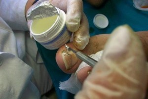 patologia-unghie-copy